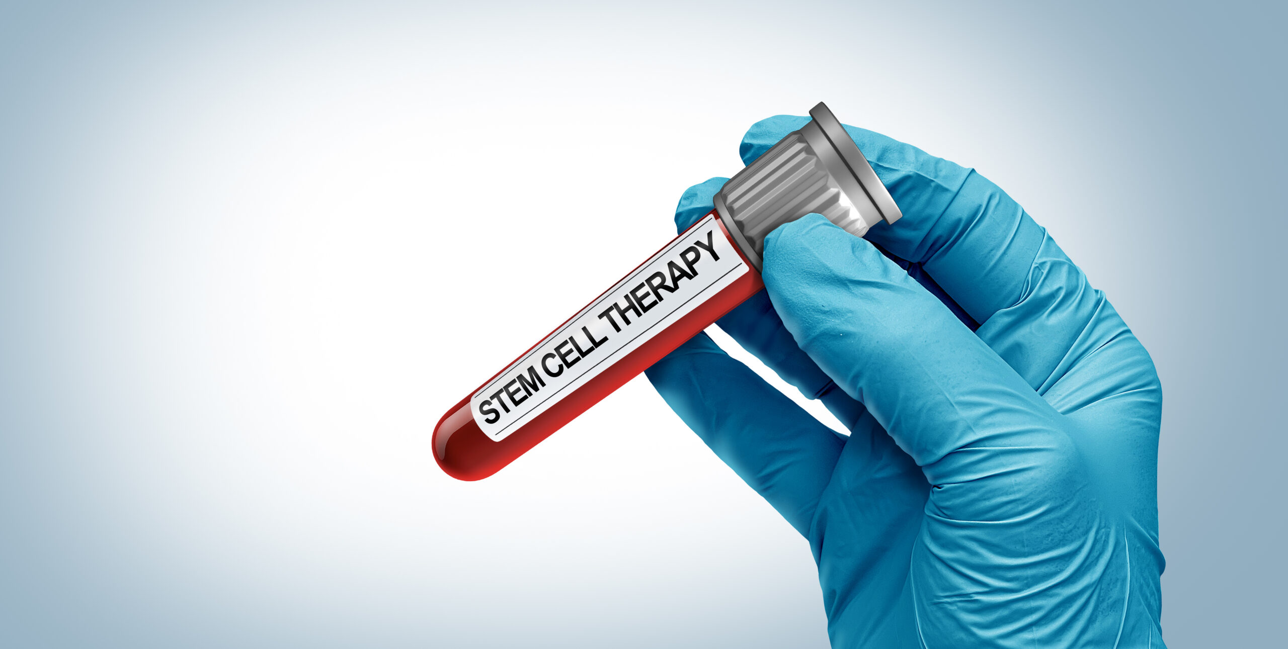 再生医療とPRPG駐車